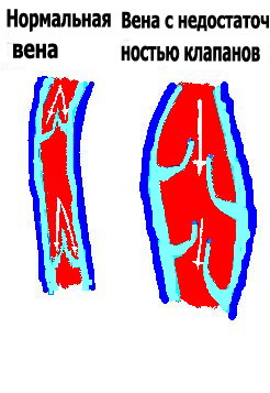 http://vein-clinic.com/images/stories/vein_rus.jpg